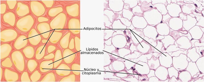 Tomografía de grasa visceral abdominal