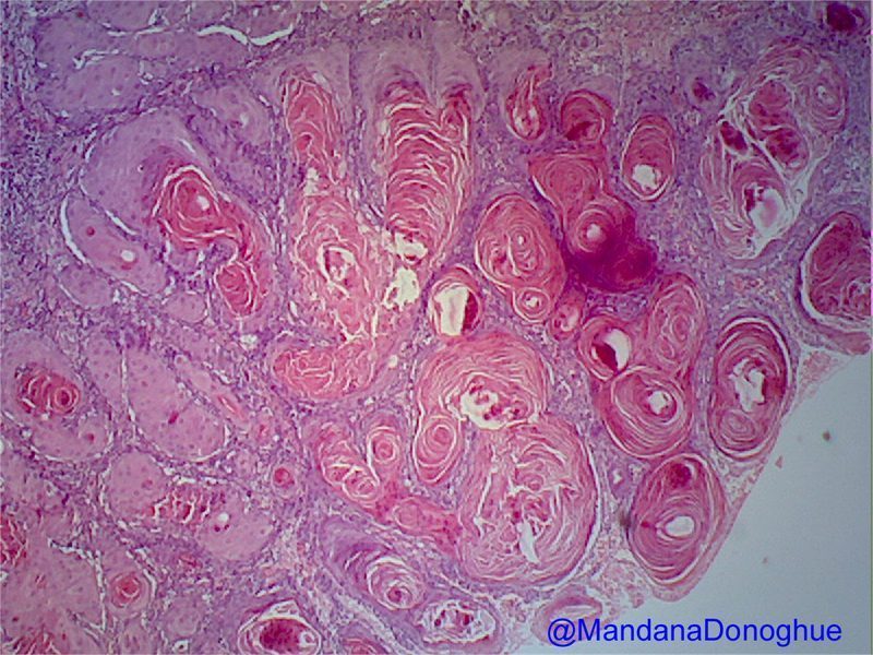 Estructura molecular de la curcumina